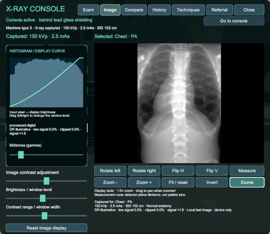 Simulated chest image with histogram, display curve, brightness, contrast and image manipulation controls.