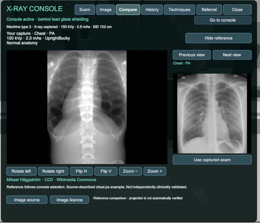Comparison workspace showing a simulated chest capture beside a source-credited chest radiograph reference.
