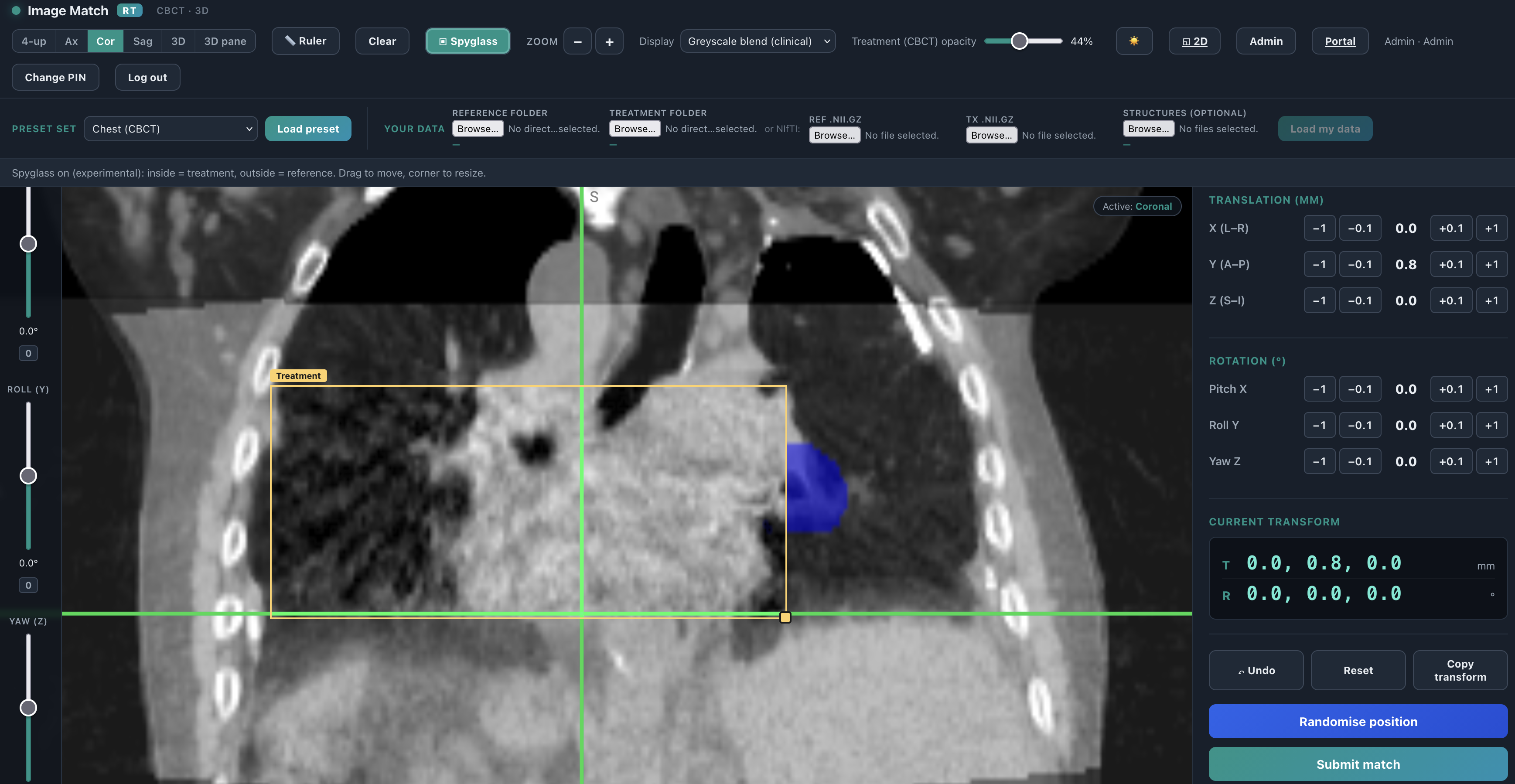 3D CBCT registration trainer — 4-up tri-planar planning CT and treatment CBCT overlay