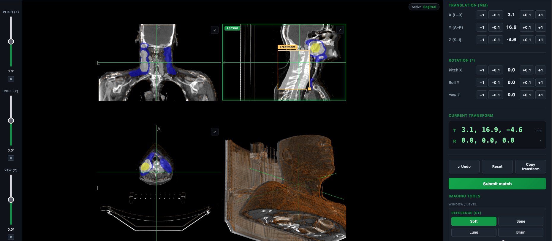 Image Match — 3D image-registration training console showing CT views, volume rendering and millimetre transform controls